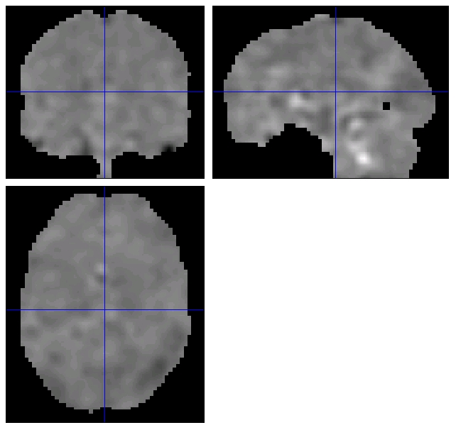 SPM orthogonal view of a residual image: greyscale coronal, sagittal and axial brain slices with blue crosshairs.
