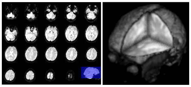 Left: a mosaic of 2D fMRI slices. Right: the same slices viewed in 3D, showing they were acquired at slightly different times.
