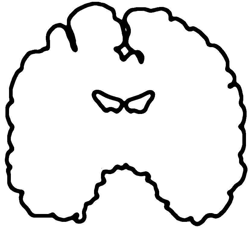 Black line drawing of a coronal (front-view) brain slice outline.